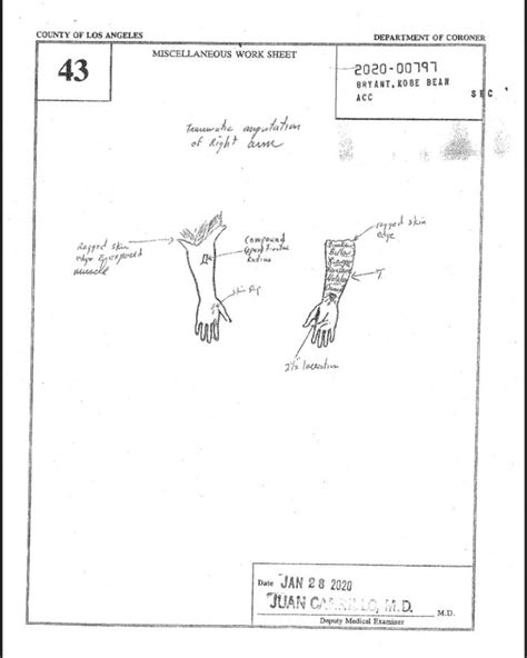 kobe and gigi autopsy picture|A top LA County coroner described in graphic。